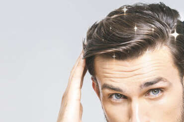 Properties of Hair Micropigmentation Dyes