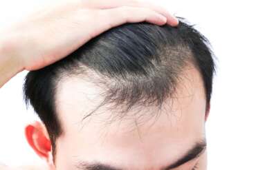 hair micropigmentation process