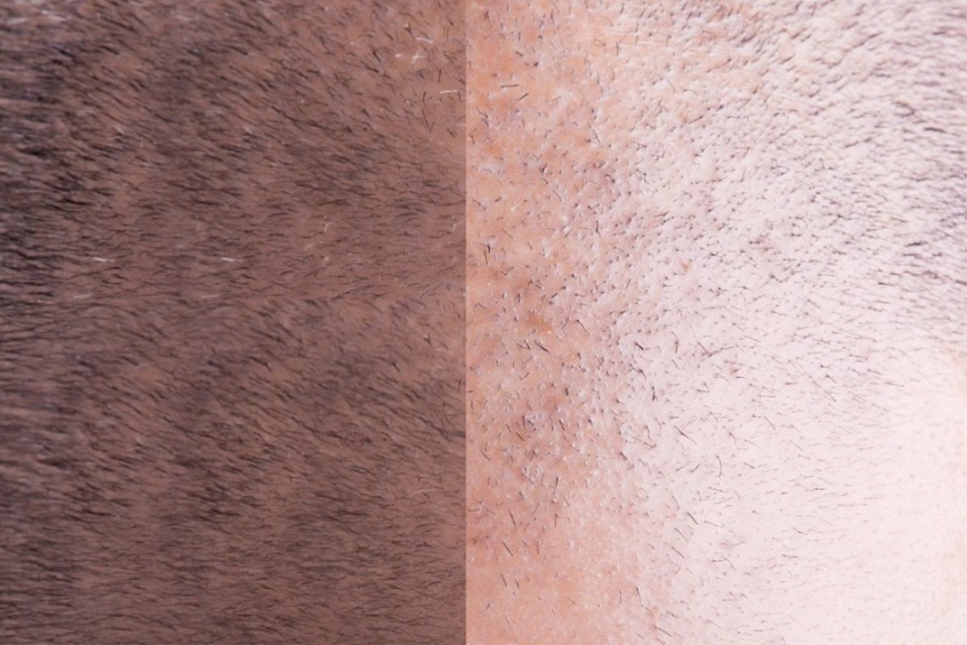 Comment la Racine des Cheveux 3D Apparaît-Elle ?