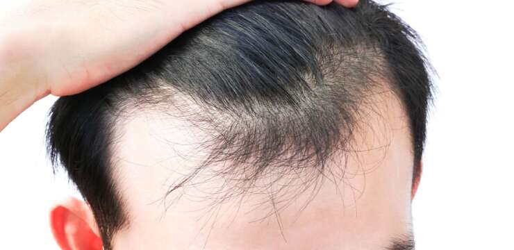 Combien de temps et combien de séances la procédure de simulation de cheveux prend-il ?