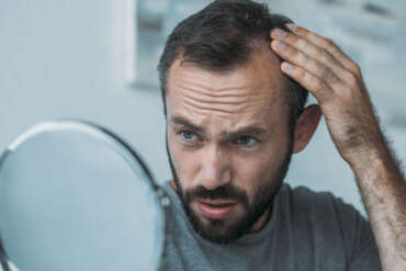 Come funziona la micropigmentazione dei capelli con capelli radi, qual è il risultato?