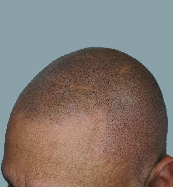 After Image