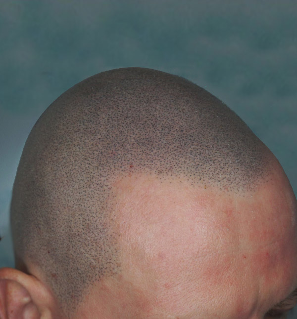 After Image