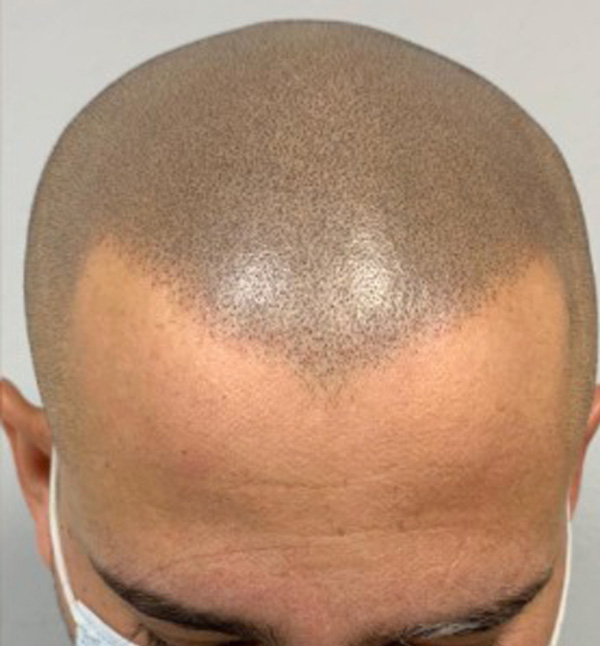 After Image
