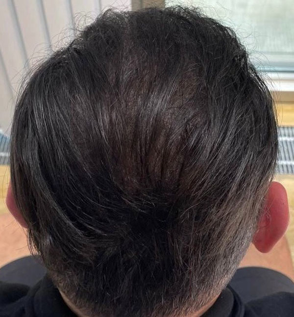After Image