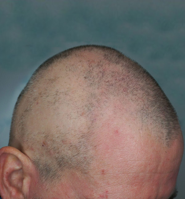 Before Image