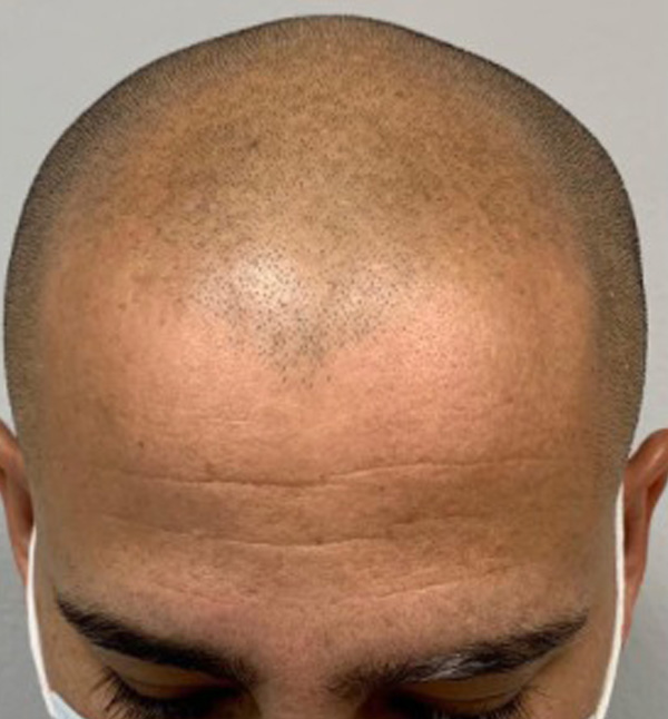 Before Image