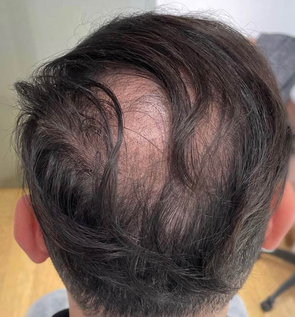 Before Image